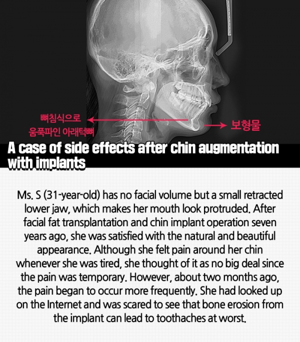 슬라이드 이미지